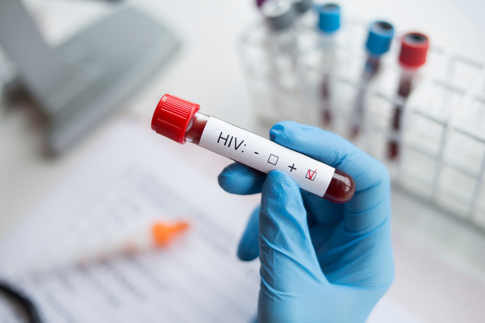 Καμπανάκι ΟΗΕ για το AIDS: Οι περικοπές χρηματοδότησης απειλούν δεκαετίες προόδου